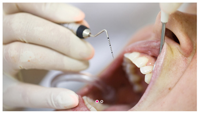 Die Zahnärzte von estethica behandeln eine Parodontis gründlich und umfassend mit oder ohne OP. Das Bild zeigt eine Parodontitis-Behandlng mit Spezialwerkzeug. 